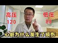 高压120，低压80，却发生了心脏损伤，病因是什么？医生说出答案