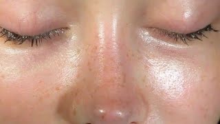 Hyderated and clearest skin