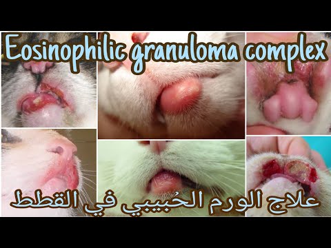 علاج الورم الحبيبي في القطط(ورم الفم في القطط) Treatment of eosinophilic granuloma complex  in cats