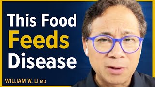 The 5 Foods I Highly Recommend Avoiding For Longevity | Dr. William Li