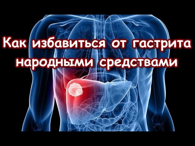 Как избавиться от гастрита народными средствами