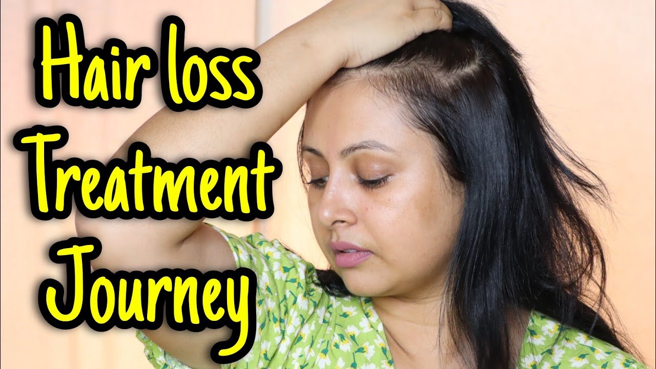 my hair loss treatment journey hair regrowth ke liye kya karen ? Kaur