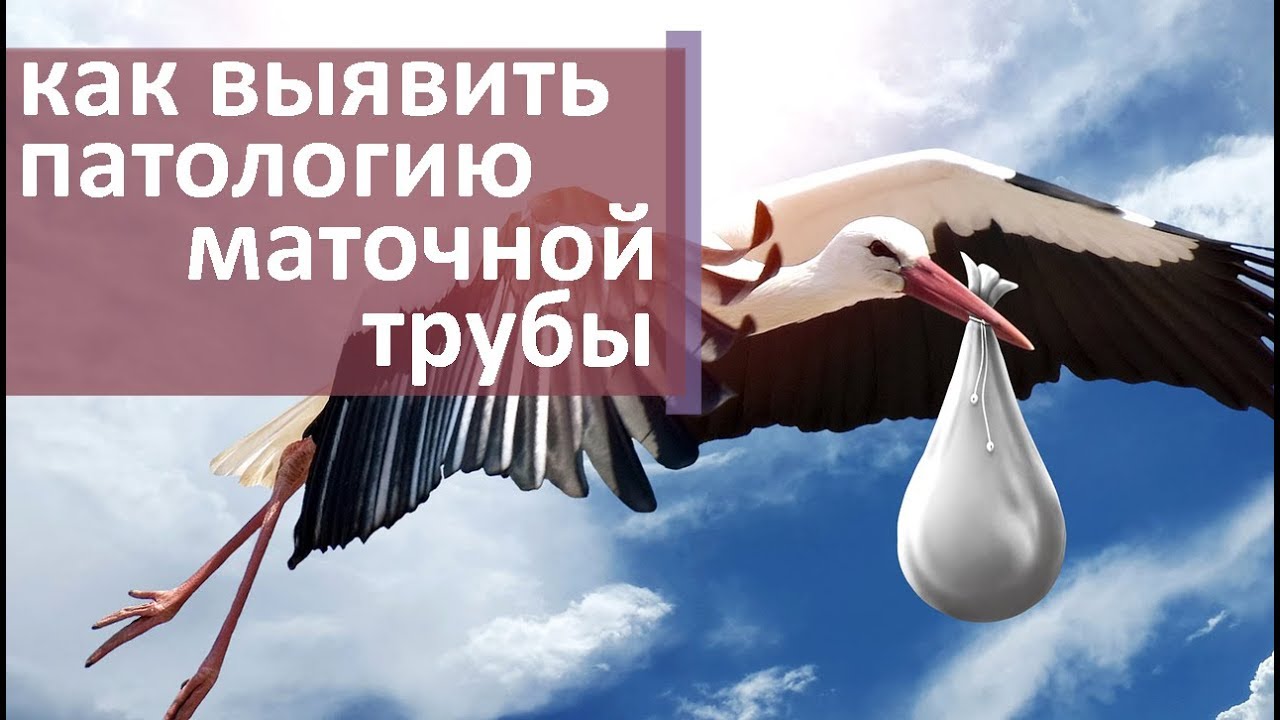 Проходимость маточных труб. ? Как делают проверку проходимости маточных труб. Моситалмед