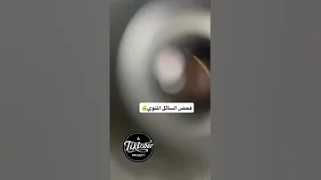 فحص السائل المنوي في المختبر 
