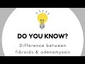 Adenomyosis versus Fibroids