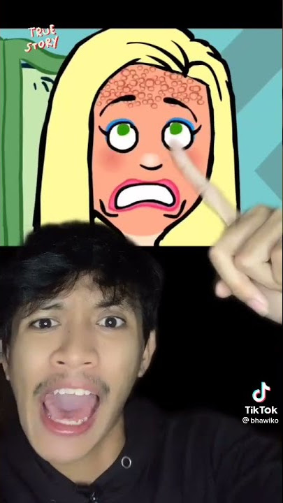 Karena jerawatan gadis ini diejek!!😡😭💦 {Part.2}
