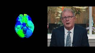 Advanced Brain Imaging Techniques | Brain Injury Law of Seattle