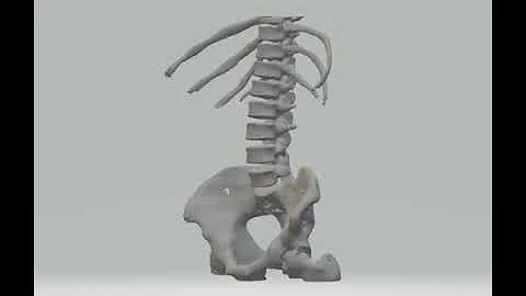 Three-dimensional reconstruction of human bones