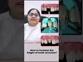 POST & CORE #delhidentalacademy #dentalexperts #dentist #dentalcoursesdelhi #handsonlearning
