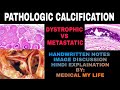 PATHOLOGIC CALCIFICATION | Dystrophic vs Metastatic Calcification