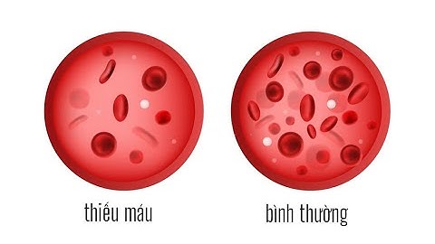 [ Nội bệnh lý ] Bệnh Tim, Thiếu máu cục bộ