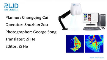 Software Operation of RWD Laser Speckle Imaging System 레이져 스펙클 이미징 시스템