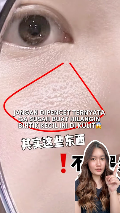 Jangan dipencet ternyata ga susah buat hilangin bintik kecil ini di kulit😱