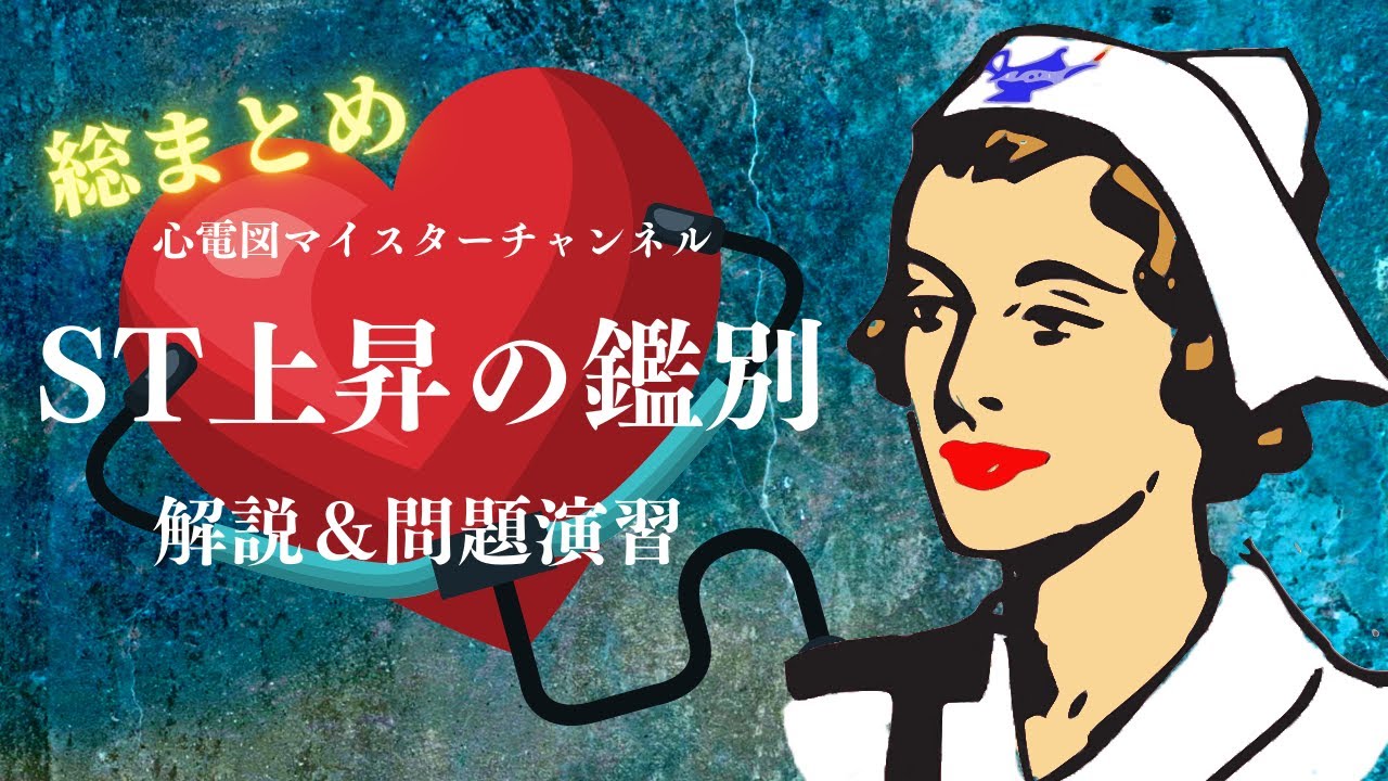 【心電図検定対策】ST上昇する疾患の鑑別　STEMI　急性心膜炎　早期再分極　たこつぼ症候群　急性心筋炎　解説と問題演習