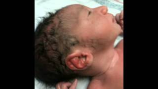 LUCAS (right after birth 8/25/2011)