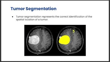 Brain Tumor Classification and Segmentation