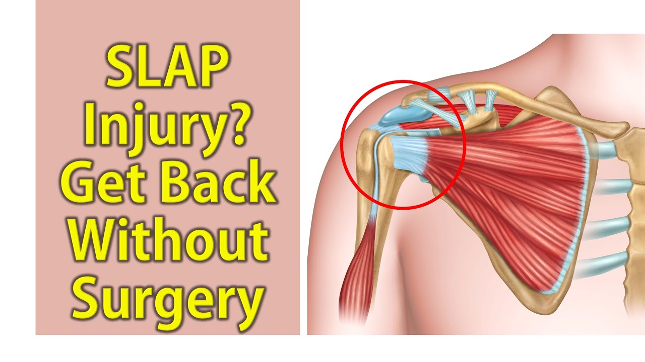 Slap Band Injuries Slap shoulder injury rehab without surgery in Trivandrum - YouTube