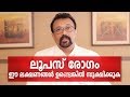     sle or lupus disease malayalam health tips