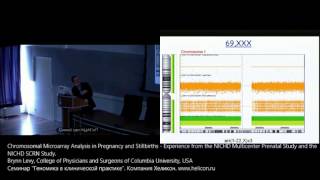 Chromosomal Microarray Analysis in Pregnancy and Stillbirths