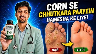 Corn Cap Wapas Phenk Do — Yeh Homeopathic Medicines Kaam Karein Jad Se | Homeomitra screenshot 1