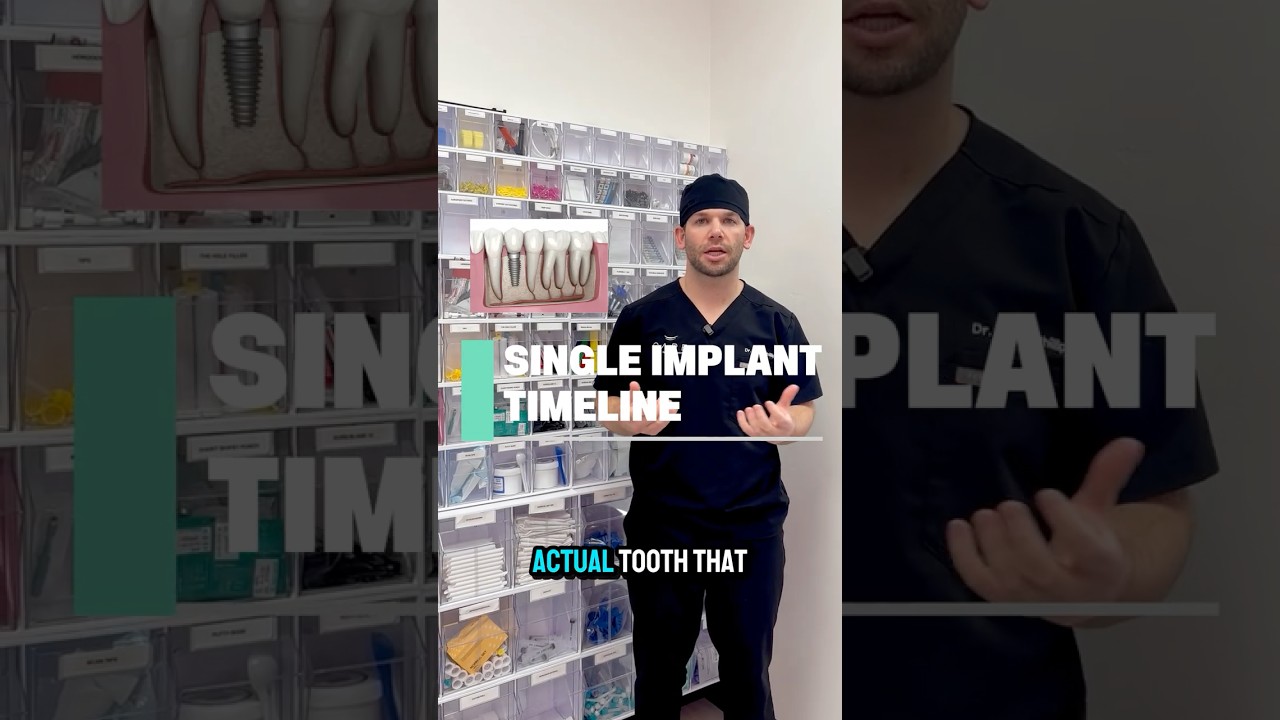 How long does it take to get a single implant?
