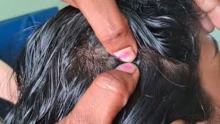 #heavy oil hair# nitpicking#by hands#long hair#with real sound#pls#youtube#viral