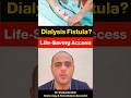 Dialysis Fistula: What Every Kidney Patient Should Know