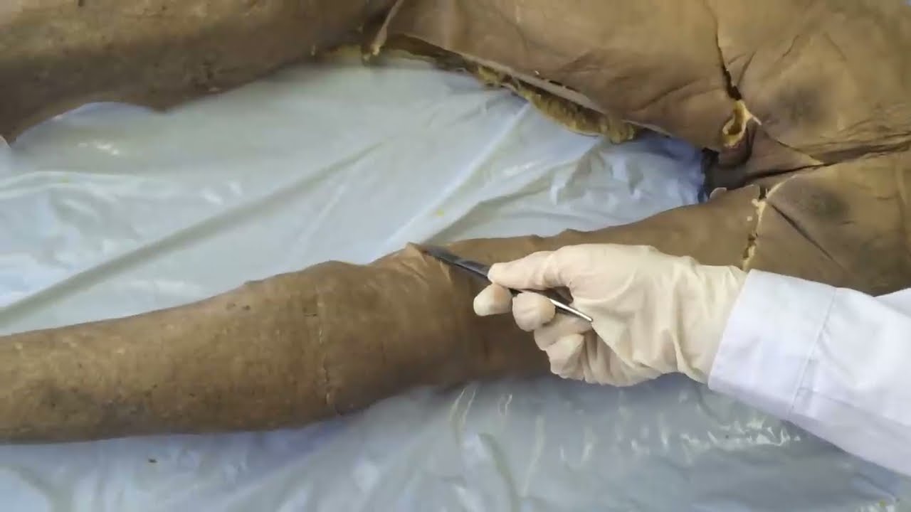 Anatomy of the Lower Limb - Incision of Gluteal Region - YouTube