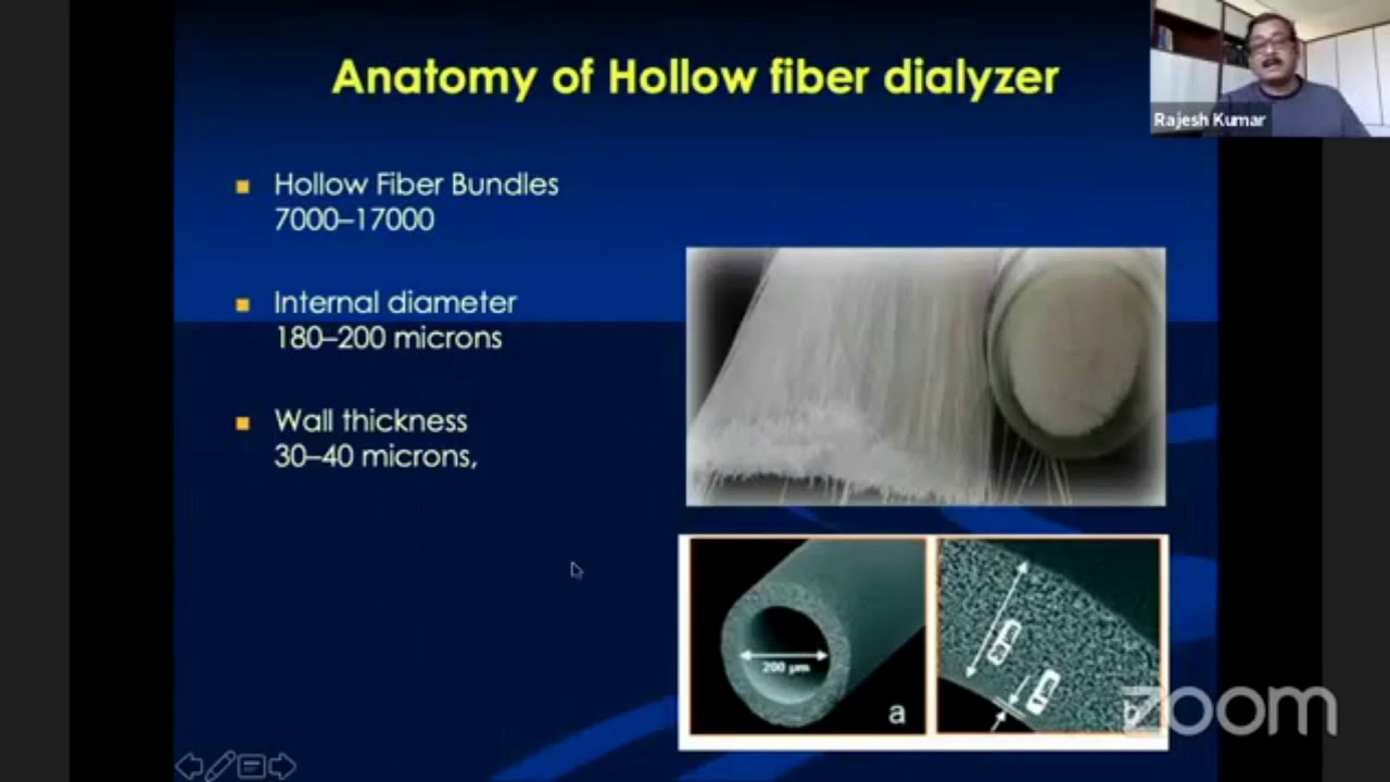 ANATOMY OF HOLLOW FIBER DIALYZER YouTube