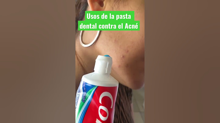 😵DEBES o NO poner Pasta dental para el acné? #shorts