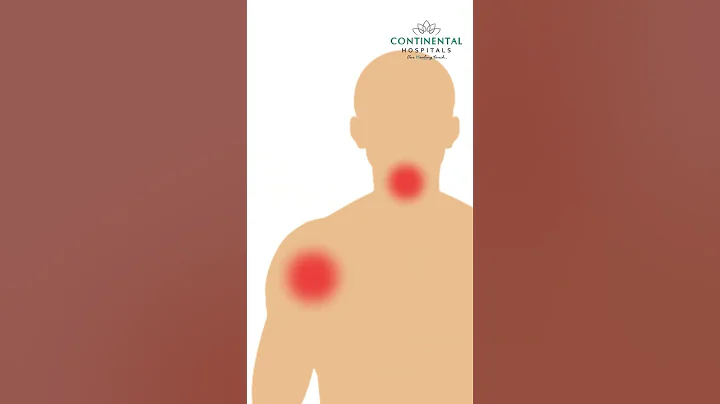 Heart Attack Symptoms | Chest Pain | Continental Hospitals #heartattack #symptoms #chestpain​ - DayDayNews