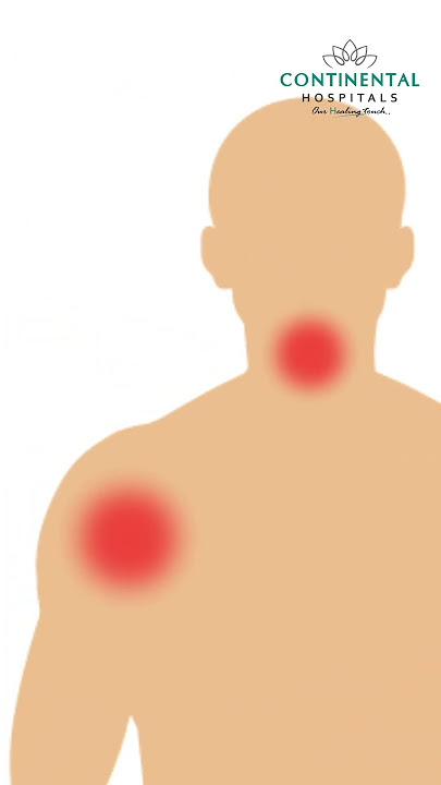 Heart Attack Symptoms | Chest Pain | Continental Hospitals #heartattack #symptoms #chestpain​