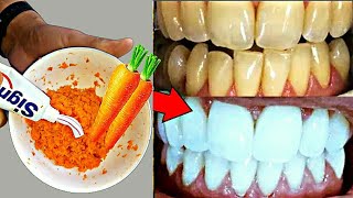 عاجل وصفة تبييض الأسنان في المنزل بسرعة من الإستعمال الأول تحصل على أسنان بيضاء بدون جير أو إصفرار