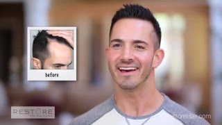 Tony G's Story - RESTORE Hair Transplant & Restoration