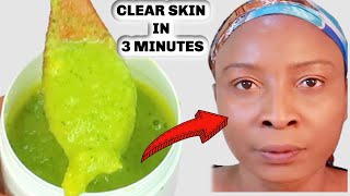 I WASH MY FACE WITH NO SOAP FACIAL WASH! LOOK WHAT IT DID TO MY SKIN! CLEAR BRIGHT SKIN IN 3 MINUTES