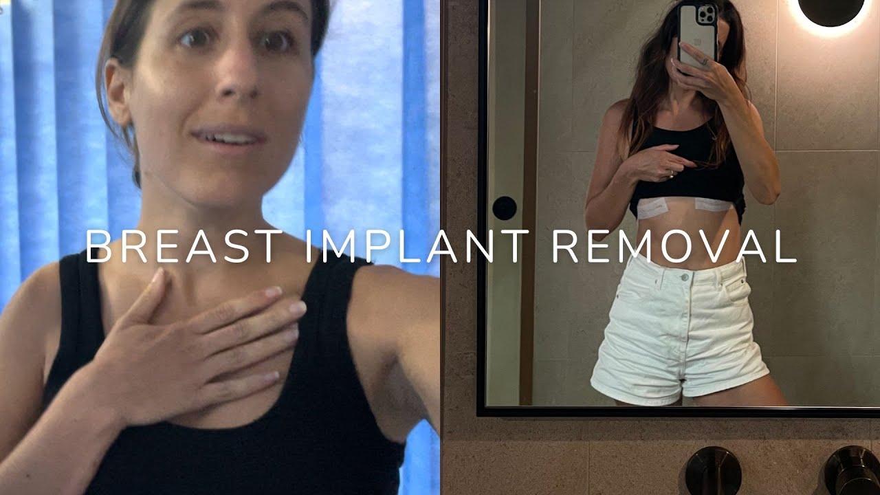 My Breast Implant Removal Journey: The Decision, Surgery & Healing 💛