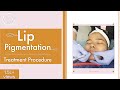 Worried about your Dark Lips watch Live lip Pigmentation Procedure Video