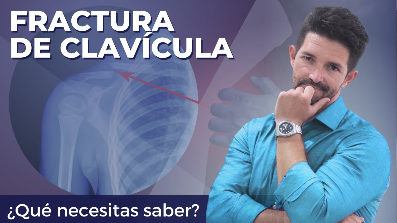 ⛔️NUNCA apliques masajes😖Clavícula rota, desde el 2do día, INICIA tú ...