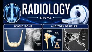 Anatomy of auditory ossicles and Hyoid bone in simple and understandable language that can help you