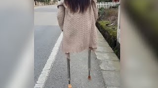 A Beautiful Girl With An Amputated Leg Walks With Crutches As Lightly As A Butterfly#Amputee#Crutche