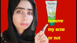 Himalaya face wash | zartasha zar | himalaya neem face wash review |