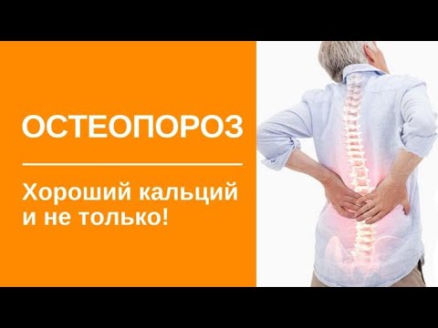 Остеопороз. Хороший кальций и не только