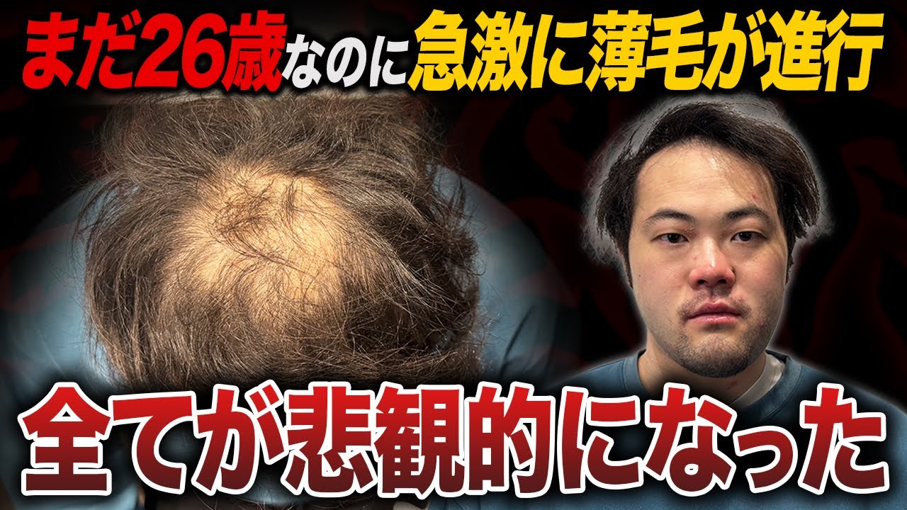【初登場】深刻な薄毛で全てに自信をなくした26歳男性を救いたい！