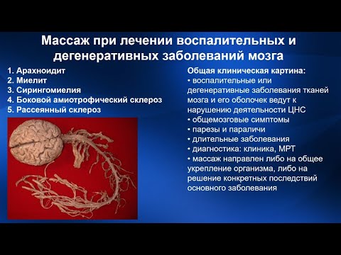 2.30. Массаж при лечении дегенеративных и воспалительных заб-й мозга | Медицинский массаж. Цикл 2