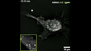 Lipid Droplet Transport: Real-Time & Label-Free