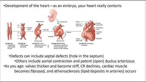 2402 Lecture Chapter 18 Heart 8 PowerPoint Screencast