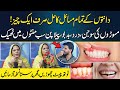 Daanto Ke Tamam Maslon Ka Hal Sirf 1 Cheez Teeth Problem Totka Naima Apa Neo Digital