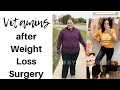 VITAMINS AFTER WEIGHT LOSS SURGERY 💊 GASTRIC SLEEVE & GASTRIC BYPASS SUPPLEMENTS