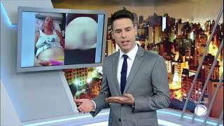 Grávido períneo inchado e