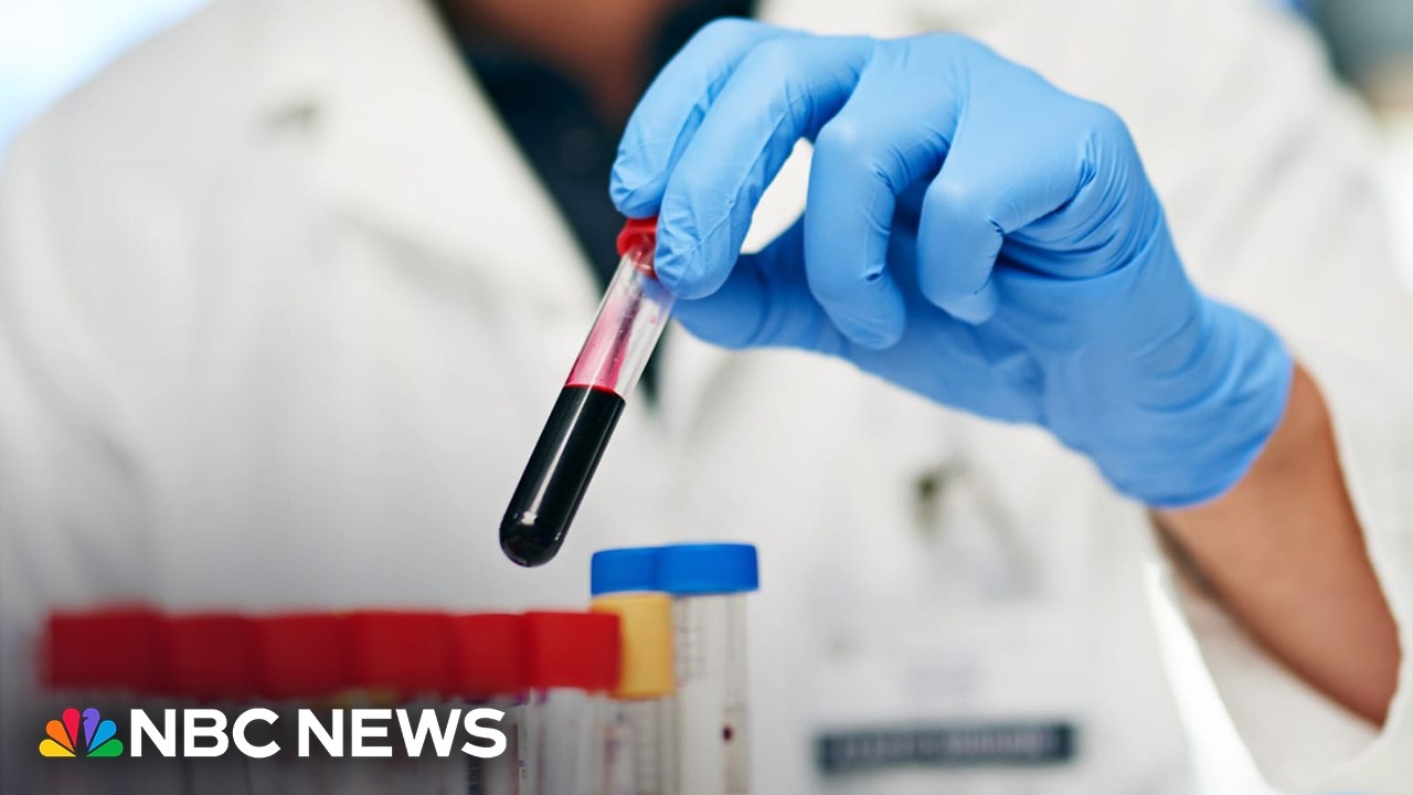 New guidelines for managing cholesterol